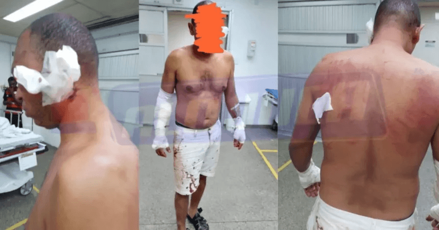 Foto: Reprodução / Alô Juca
