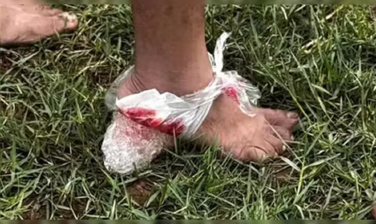 Vítimas tiveram ferimentos nos pés após ataque de piranhas em Iaçu.