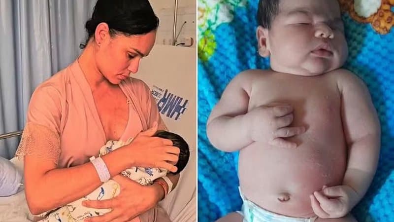 Bebê recém-nascido em maternidade, ilustrando caso de macrossomia fetal em Pernambuco