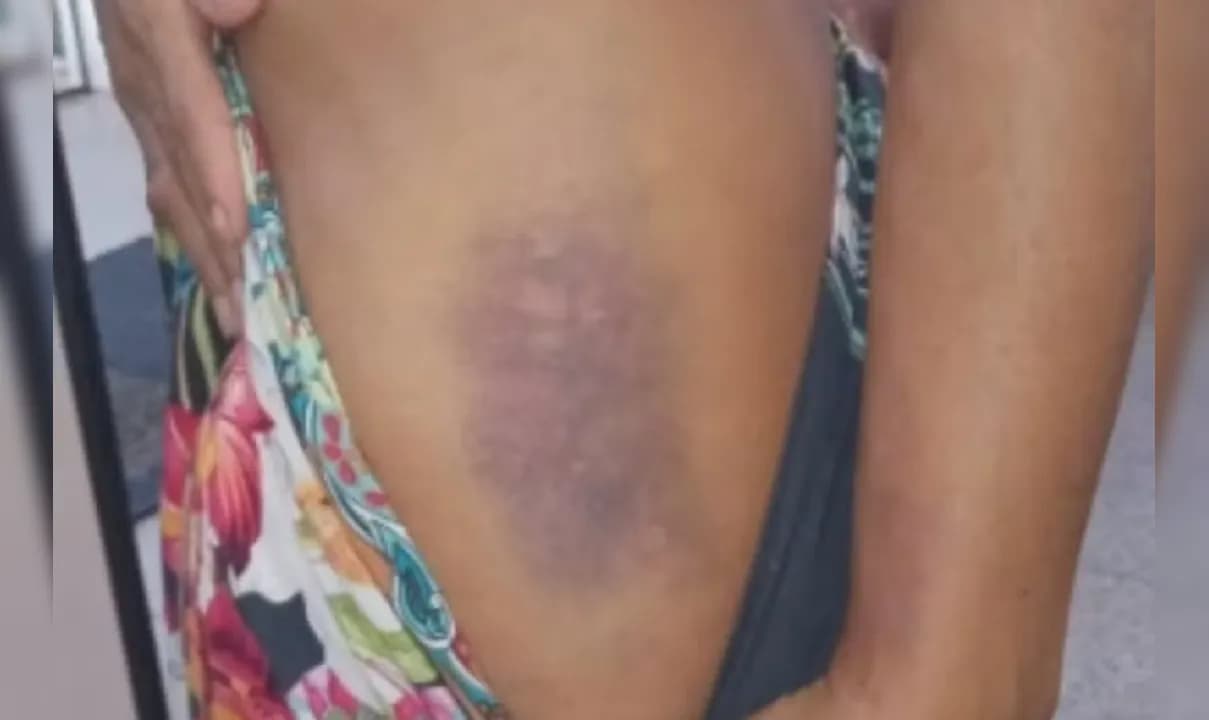 Mulher é espancada pelo ex-companheiro em Caraíva.