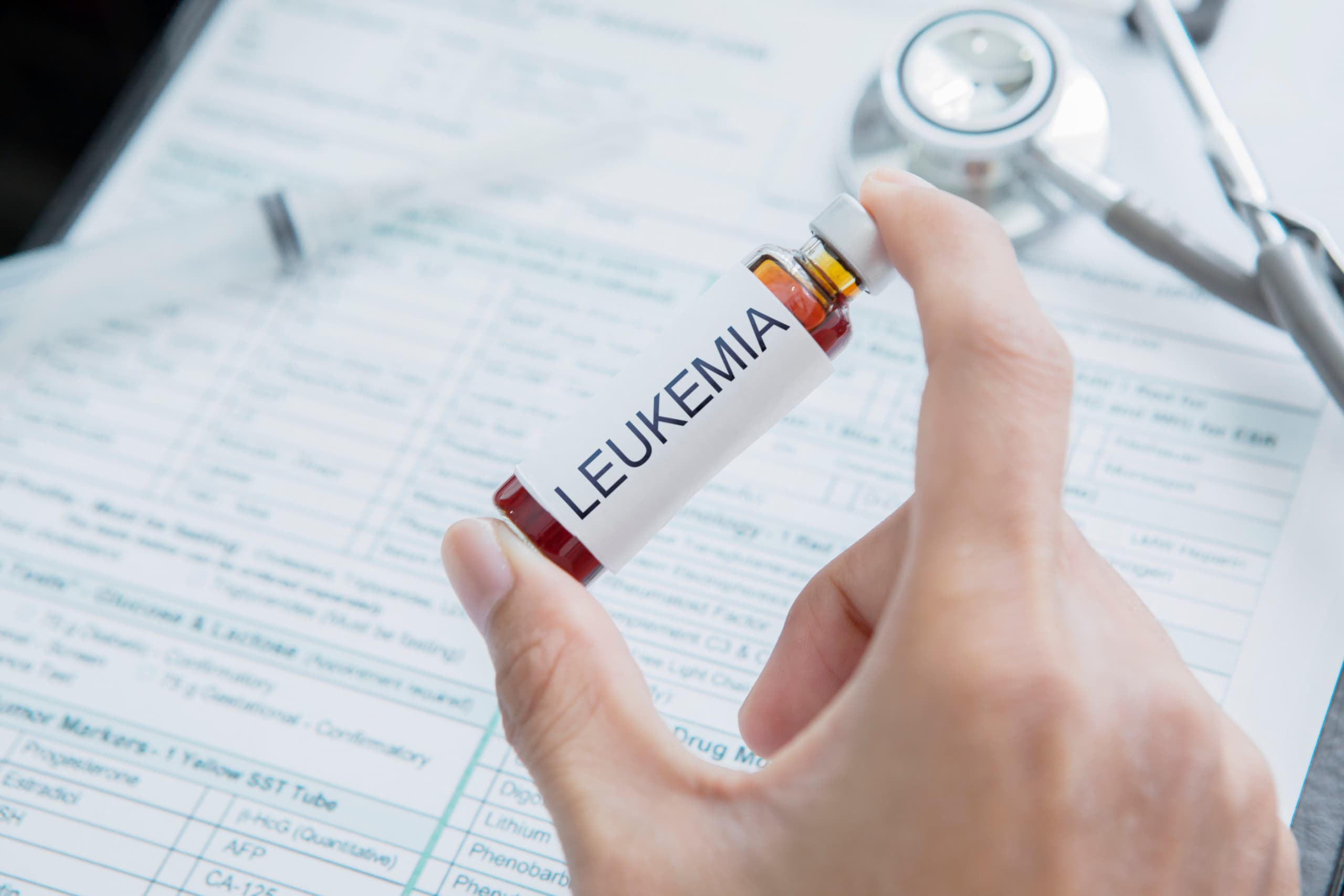 Tratamento experimental de leucemia alcança remissão em 7 de 11 pacientes (Imagem: Creativa Images / Shutterstock)