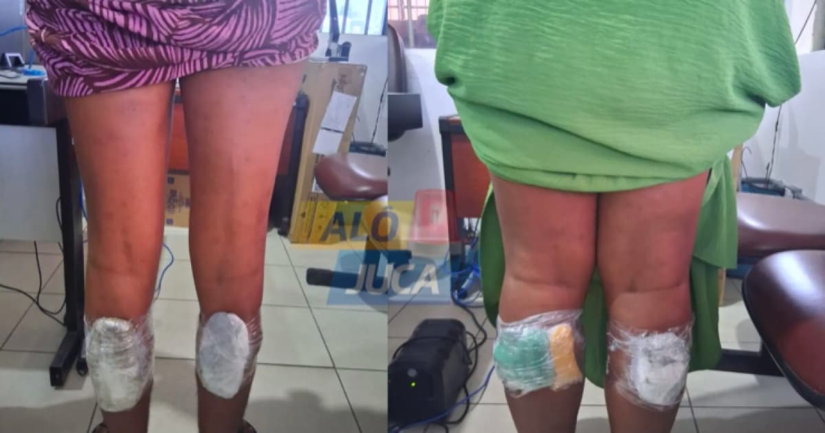 Foto: Reprodução / Alô Juca