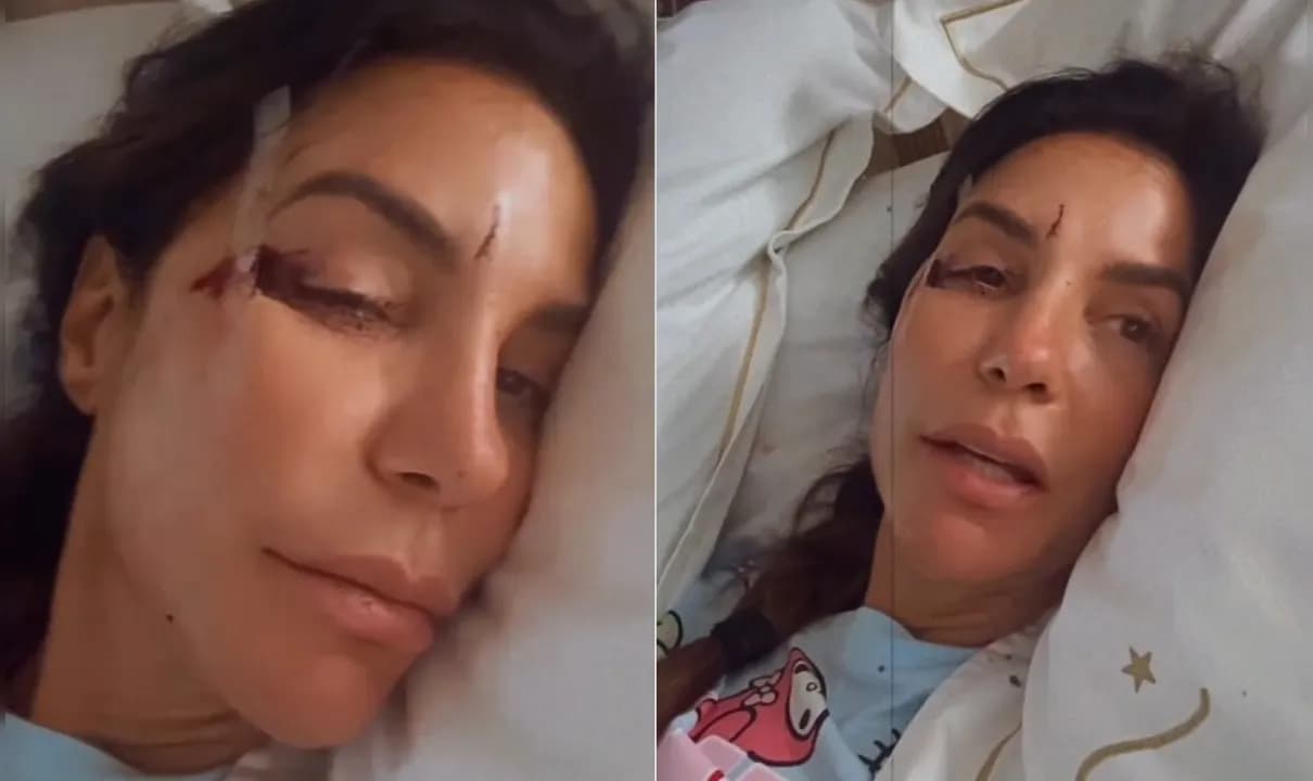 Cantora sofreu um acidente doméstico após desmaiar na própria residência.
