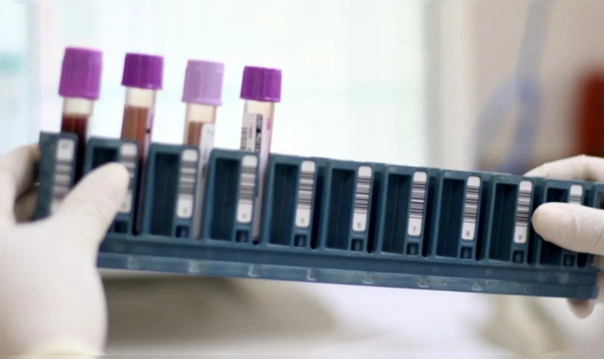 Exame reduz tempo de diagnóstico de anos para meses e já tem locais de coleta definidos no estado.