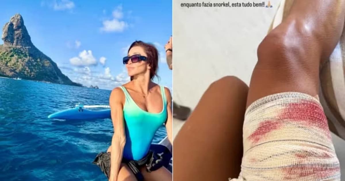 Foto: Reprodução Redes Sociais