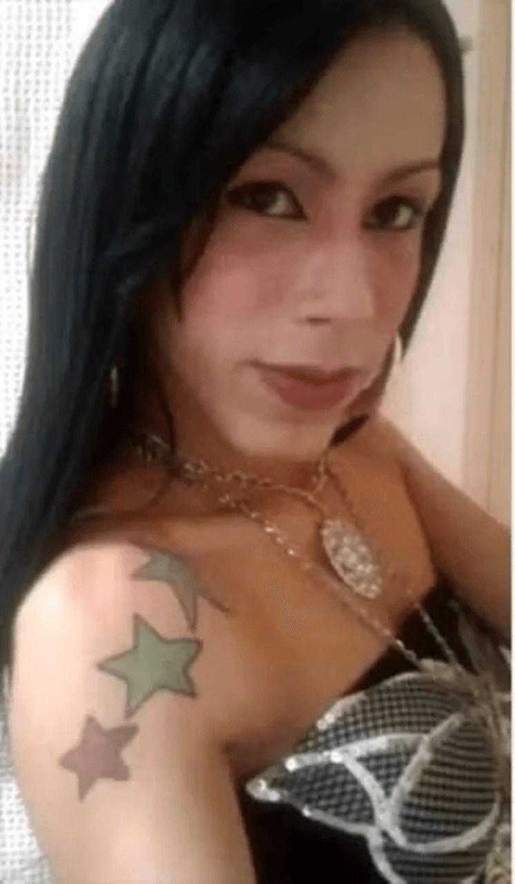 Juliana Oliveira antes da aplicação do óleo mineral (Imagem: Reprodução/Redes sociais)