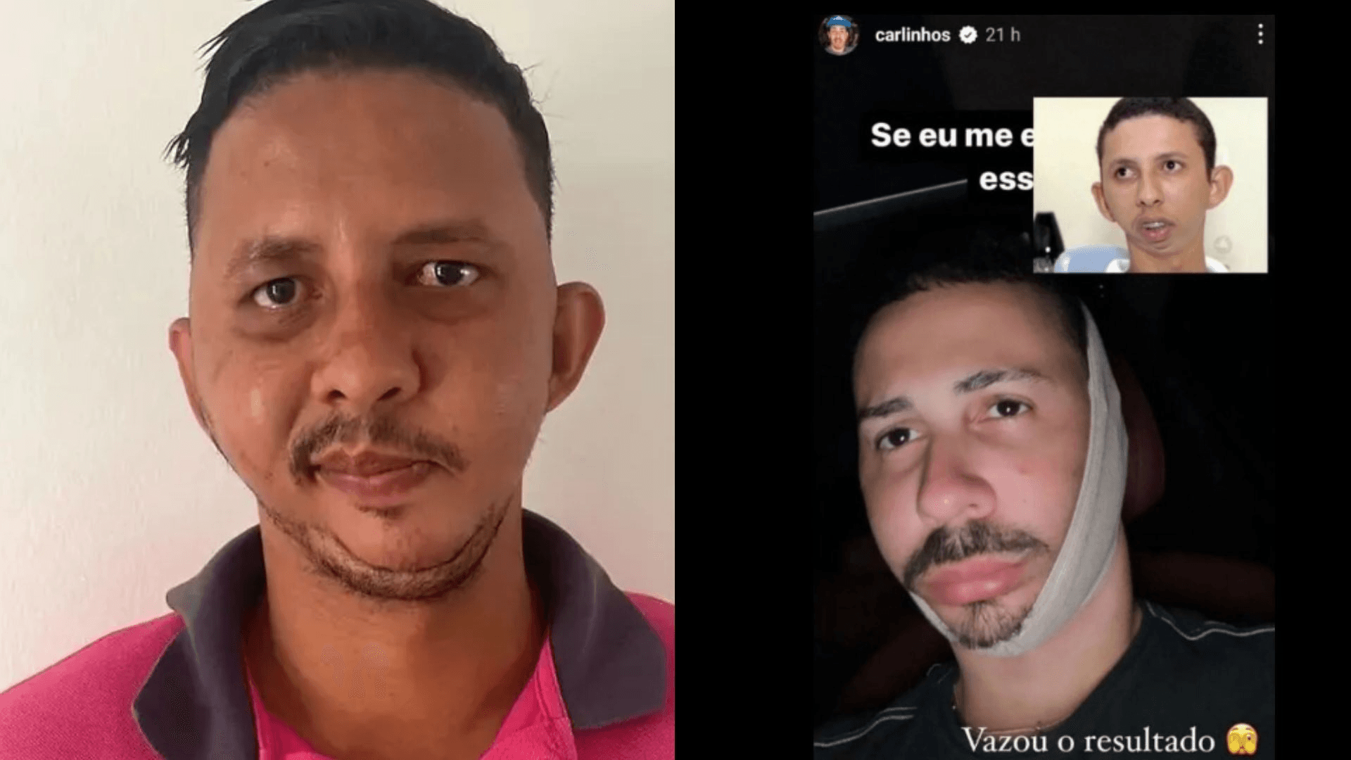 Imagem: Reprodução/Redes sociais