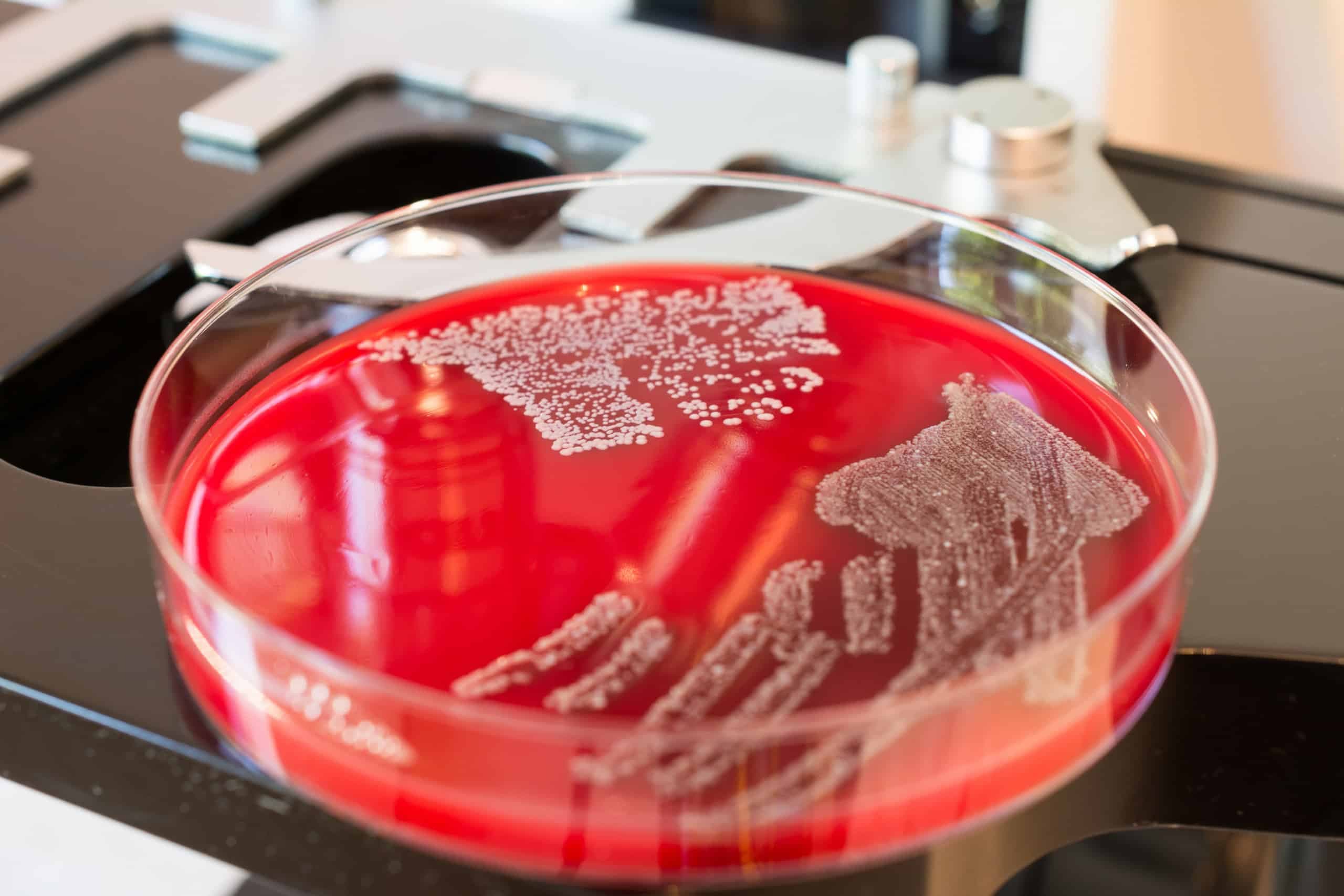 Enzima desmonta proteção de bactéria resistente e aumenta ação de antibióticos (Imagem: Zaharia Bogdan Rares / Shutterstock)