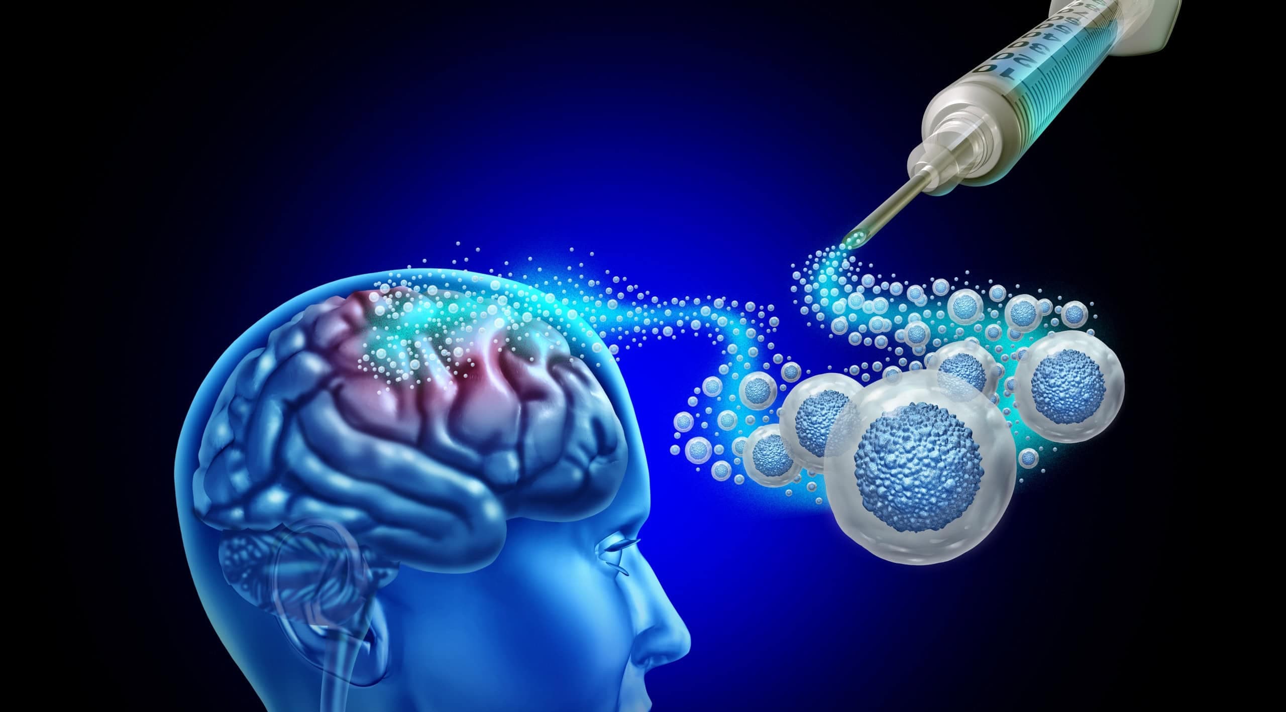 Engenharia genética e células-tronco abrem novas perspectivas para tratar danos no cérebro (Imagem: Lightspring / Shutterstock)