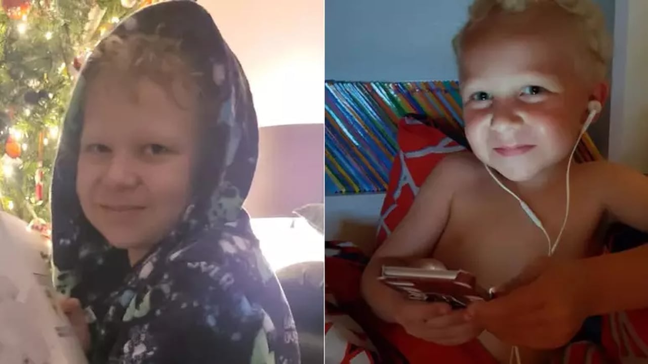 Menino de 12 anos morre após inalar desodorante em desafio do TikTok