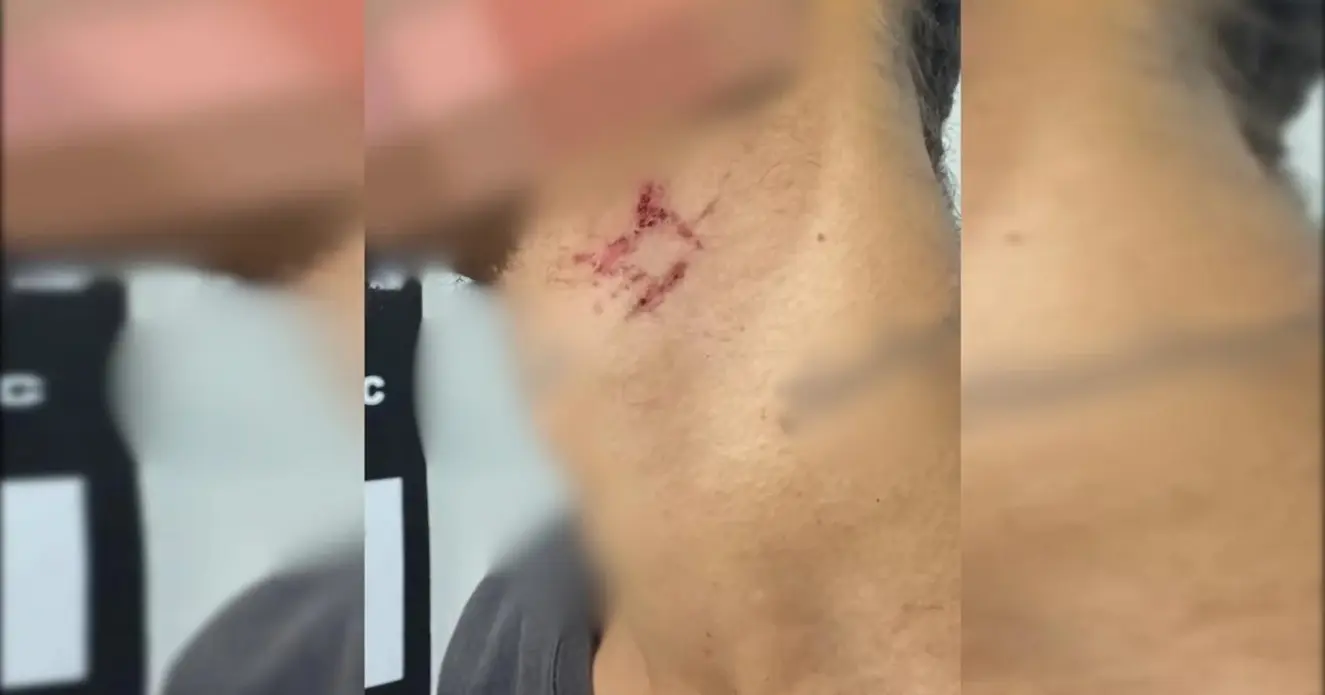 Jovem de 22 resgatado após mais de um ano em cárcere e estupro em Goiânia