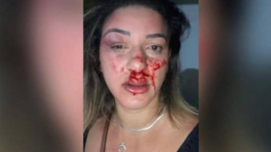 Mulher É Espancada E Faz Vídeo Após Ataque: &Quot;Isso Foi Meu Ex&Quot;