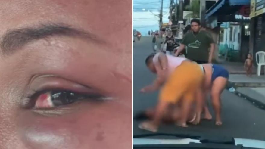 Violência: Mulher Grávida É Agredida Por Três Pessoas No Meio Da Rua; Assista