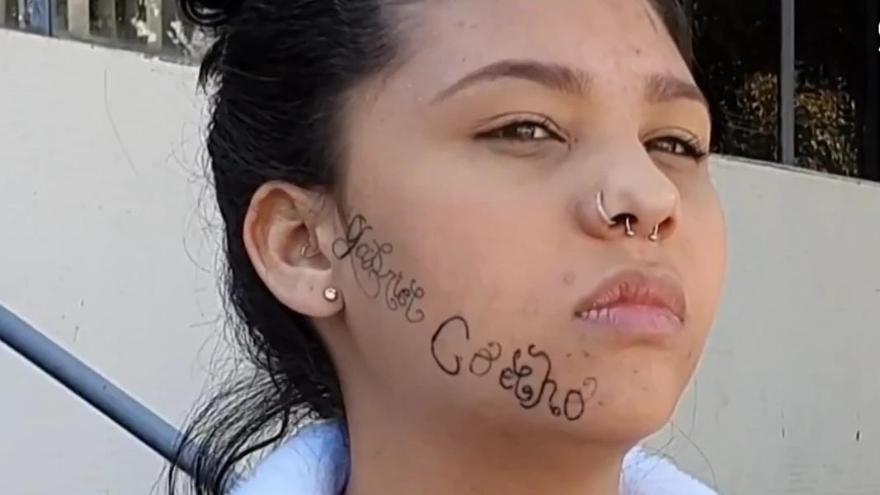 Jovem Que Teve Rosto Tatuado Por Ex