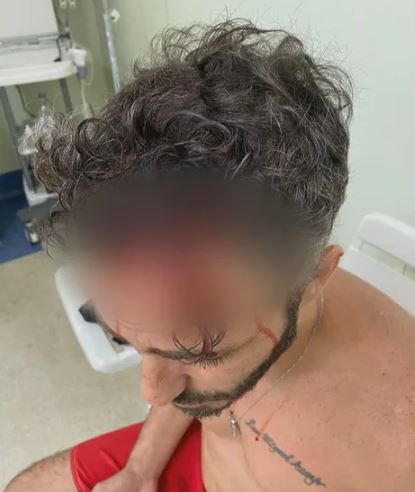 Ator Thiago Rodrigues É Assaltado E Espancado No Rj