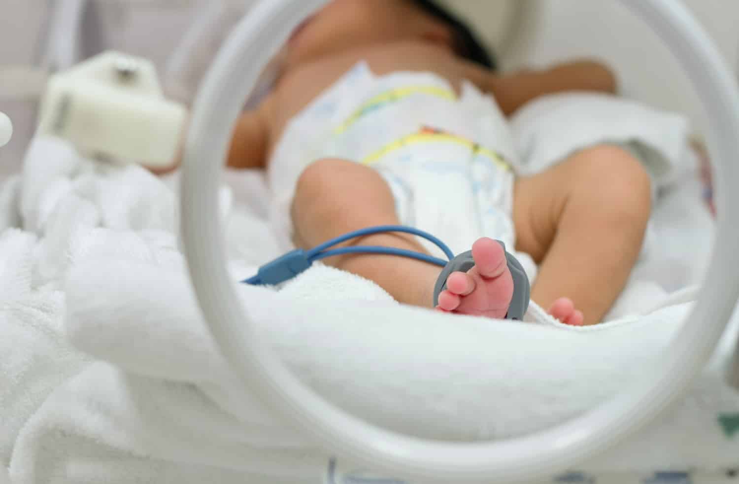 Bahia Registra Maior Número De Internação De Bebês Por Desnutrição Do País 