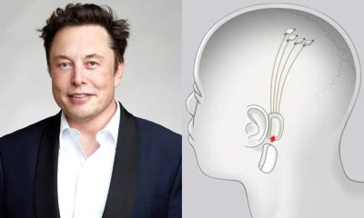 Avanço Médico: Elon Musk Anuncia O Implante De Chip Em Cérebro De Paciente Paralítico Pela Primeira Vez