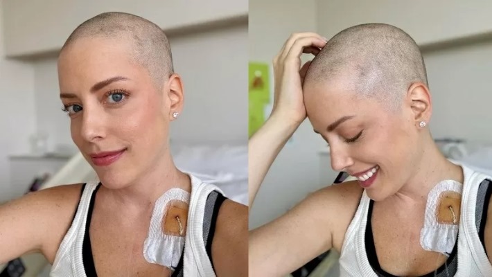 Fabiana Justus Toma A Decisão De Raspar O Cabelo Após Diagnóstico De Leucemia