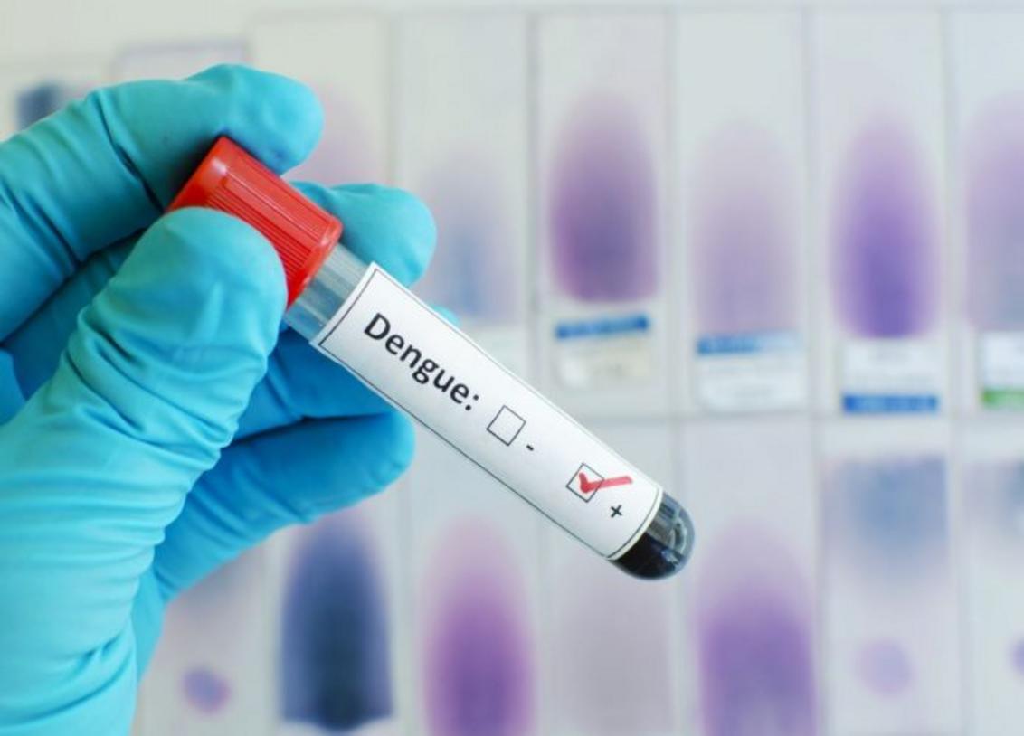 Dengue