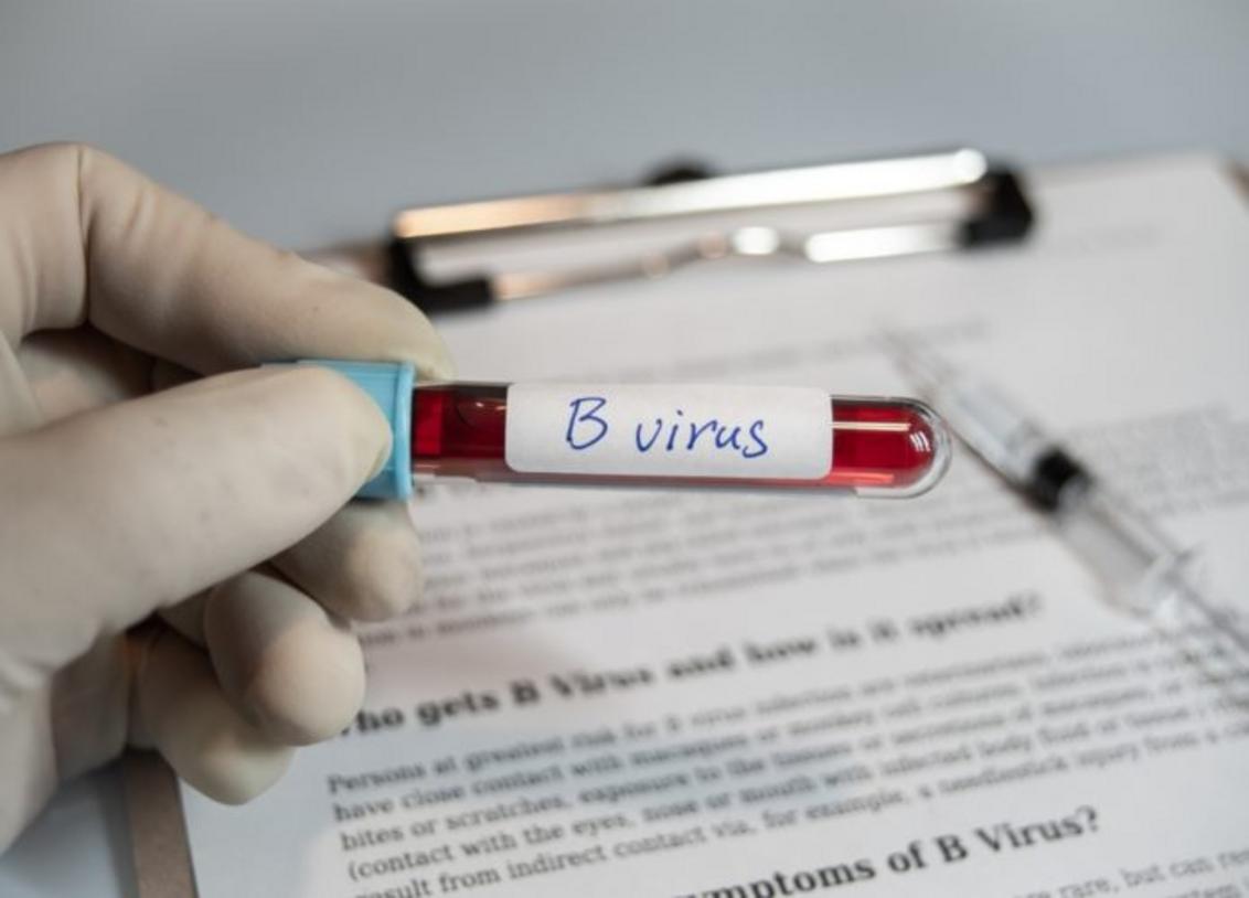 Vírus