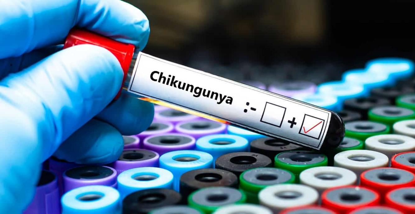 Chikungunya