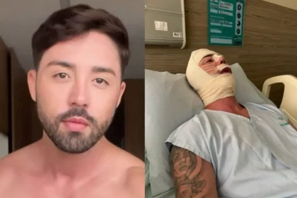 Rico Melquiades Após 11ª Cirurgia Plástica (Reprodução-Instagram/Leodias)