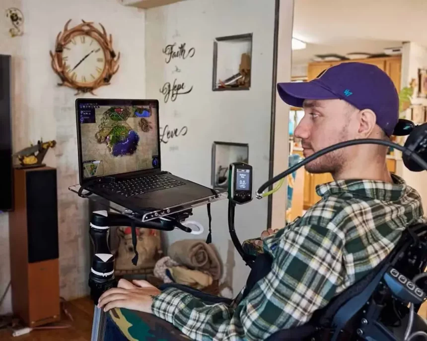 Arbaugh Tem Mais De Um Ano Com O Chip Cerebral (Imagem: Reprodução/X)