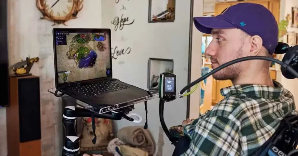 Arbaugh Tem Mais De Um Ano Com O Chip Cerebral (Imagem: Reprodução/X)