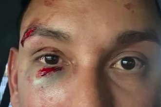 Foto: Reprodução / Redes Sociais
