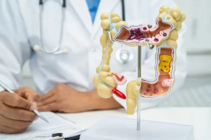Um Dos Grandes Desafios Da Prevenção Do Câncer De Apêndice É A Dificuldade De Diagnóstico (Imagem: Ilya Lukichev/Istock)