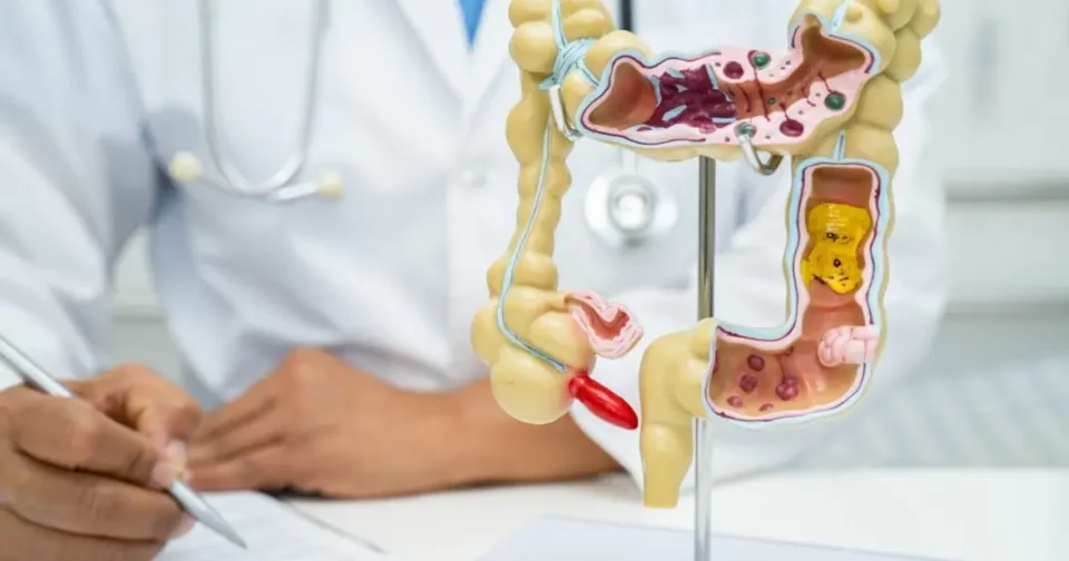 Um Dos Grandes Desafios Da Prevenção Do Câncer De Apêndice É A Dificuldade De Diagnóstico (Imagem: Ilya Lukichev/Istock)
