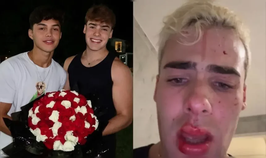 Influenciador Foi Acusado De Agredir Namorado Durante Férias Na Europa. ​
