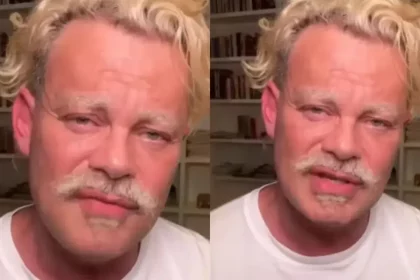 Ator Fez Alerta Sobre Doença, Mas Sua Aparência Virou O Foco Dos Comentários. ​