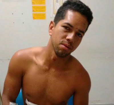 Glória- Ba: Jovem É Baleado Durante Tentativa De Homicídio No Povoado Quixaba