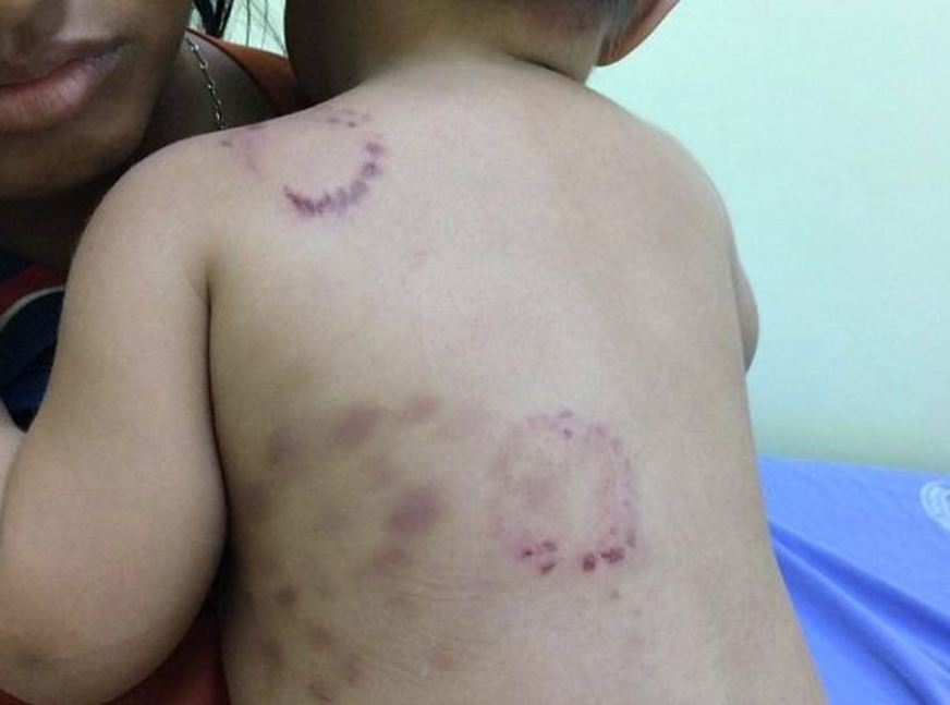 Brasil: Bebê Foi Torturado E Abusado Sexualmente Por Menor De 17 Anos