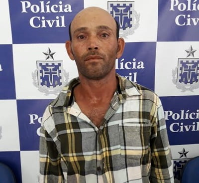 Paulo Afonso: Homem Ataca Companheira Com Golpes De Facão Por Vítima Usar Short Curto